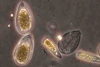 microscopic algae